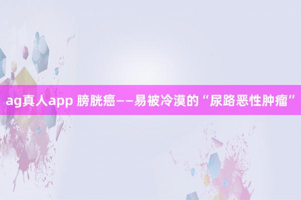 ag真人app 膀胱癌——易被冷漠的“尿路恶性肿瘤”
